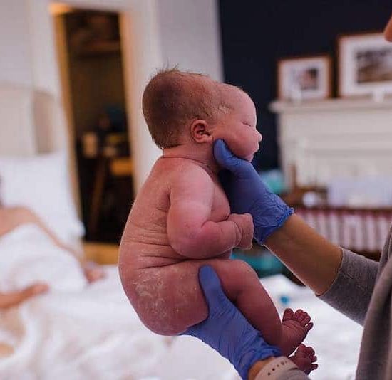 Sutures & Fontanelles